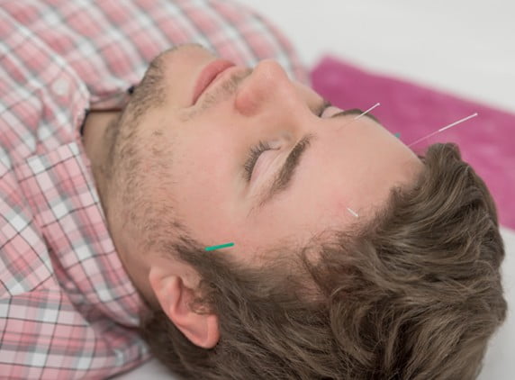 Acupuncture for Stress, Anxiety and Depression in London