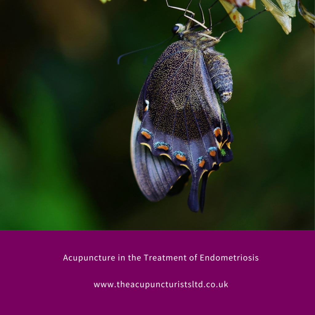 Acupuncture for the Treatment of Endometriosis